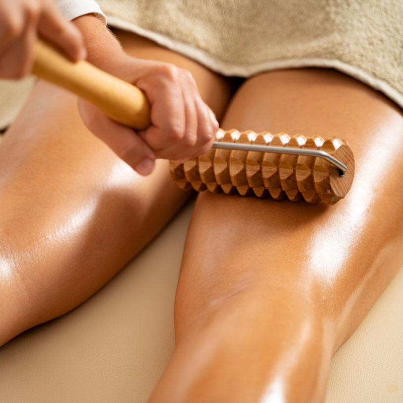 Cellulite